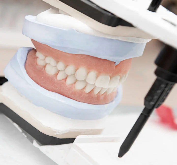 Zahnmodell im Artikulator